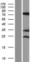 Human RAVER1 Protein (Over-Expression Lysate Myc-DDK (Flag))