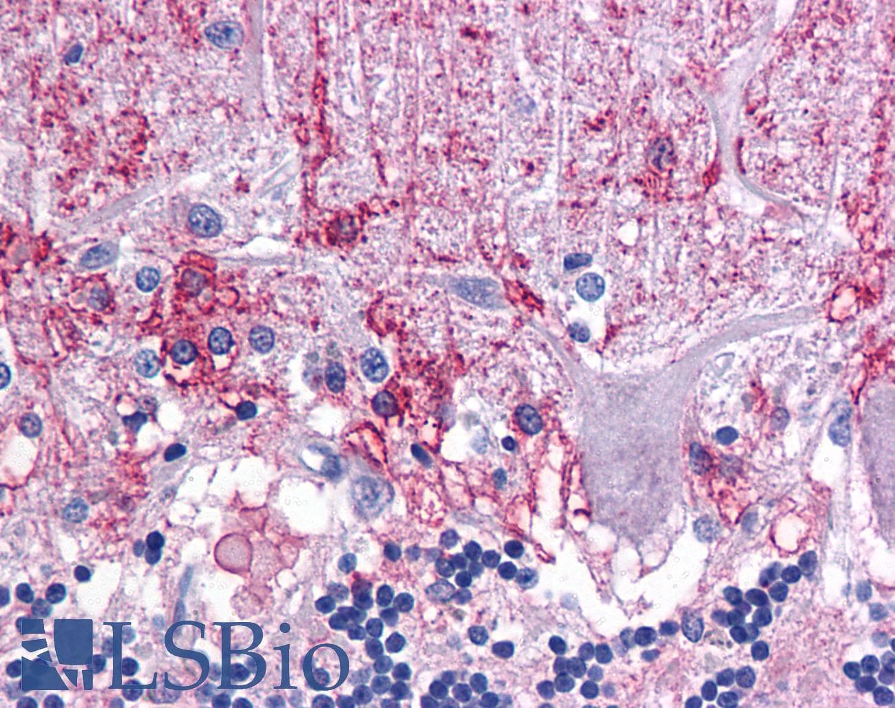 IHC-plus™ Polyclonal Rabbit anti-Human KPNA3 / Importin Alpha 4 Antibody (IHC, IF, WB)