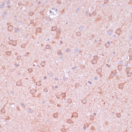 Polyclonal Rabbit anti-Human TIMM8B Antibody (IHC, IF)