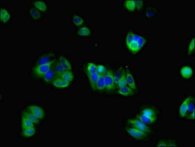 GRIN2A / NMDAR2A / NR2A Antibody (aa501-750)