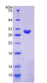 Human MKI67 / Ki67 Protein (Recombinant 6His, N-terminus)