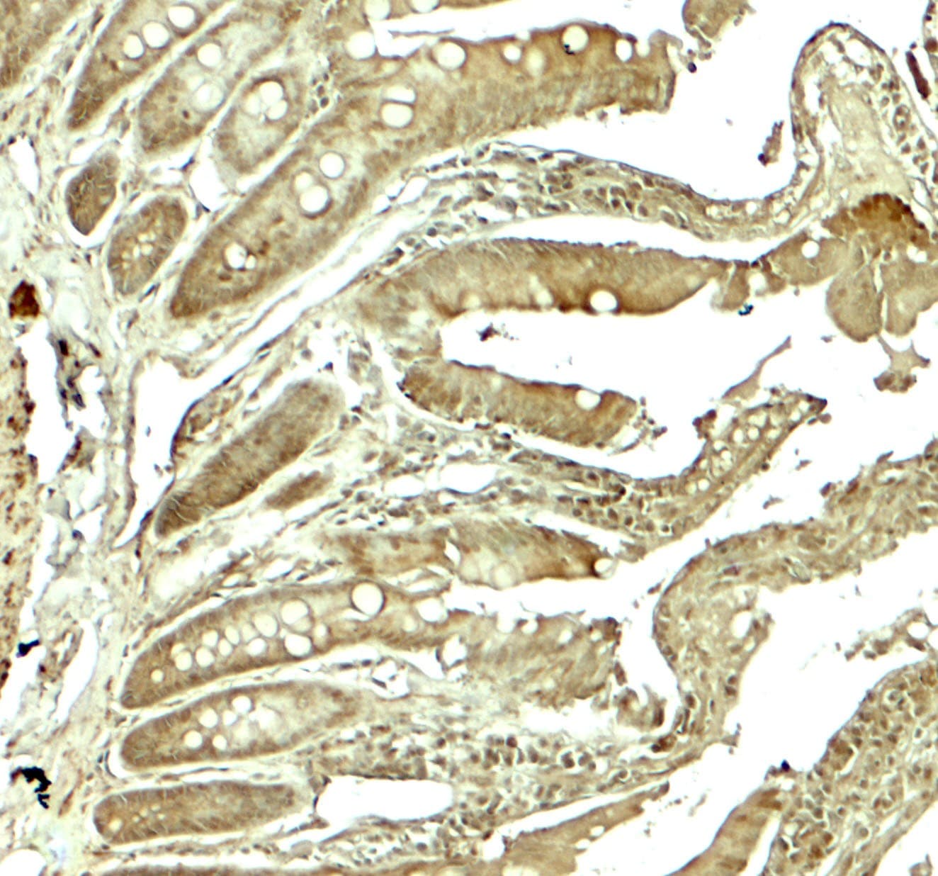 IHC-plus™ Polyclonal Rabbit anti-Human ADORA2B/Adenosine A2B Receptor Antibody (IHC, IF, WB)