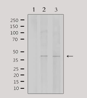 Polyclonal Rabbit anti-Human WTAP Antibody (IF, WB)