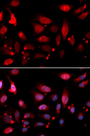 Polyclonal Rabbit anti-Human RACGAP1 / MGCRACGAP Antibody (IHC, IF, WB)