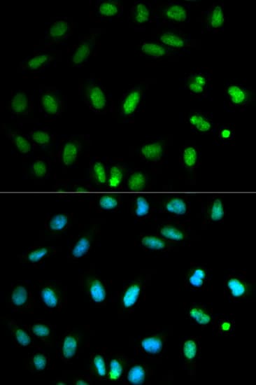 Selenium Binding Protein 1 Antibody