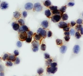 Polyclonal Rabbit anti-Human ANXA5 / Annexin V Antibody (aa88-102, IHC, WB)