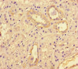 TANK2 / TNKS2 Antibody
