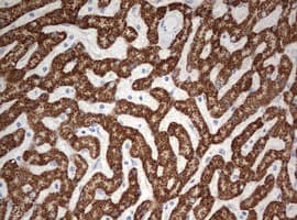 Monoclonal Mouse anti-Human OTC Antibody (clone OTI4G8, aa33-354, IHC, WB)