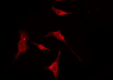 ADRB2 Antibody