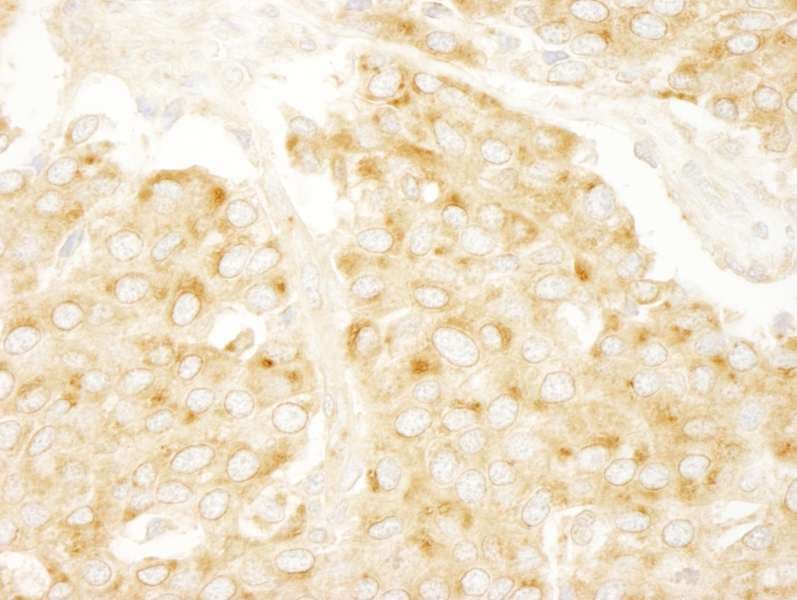 PRKAR2A Antibody (aa50-100)