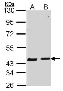 Polyclonal Rabbit anti-Human SERPINB6 / PI-6 Antibody (aa66-313, IHC, WB)