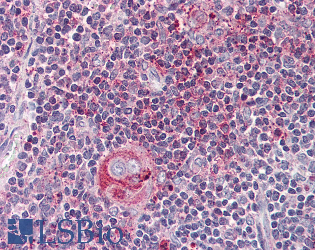 IHC-plus™ WNT5B Antibody (Internal)