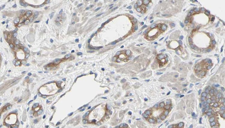 RRM2 Antibody
