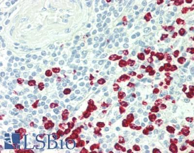 IHC-plus™ Polyclonal Rabbit anti-Human IL3 Antibody (Internal, IHC, WB)