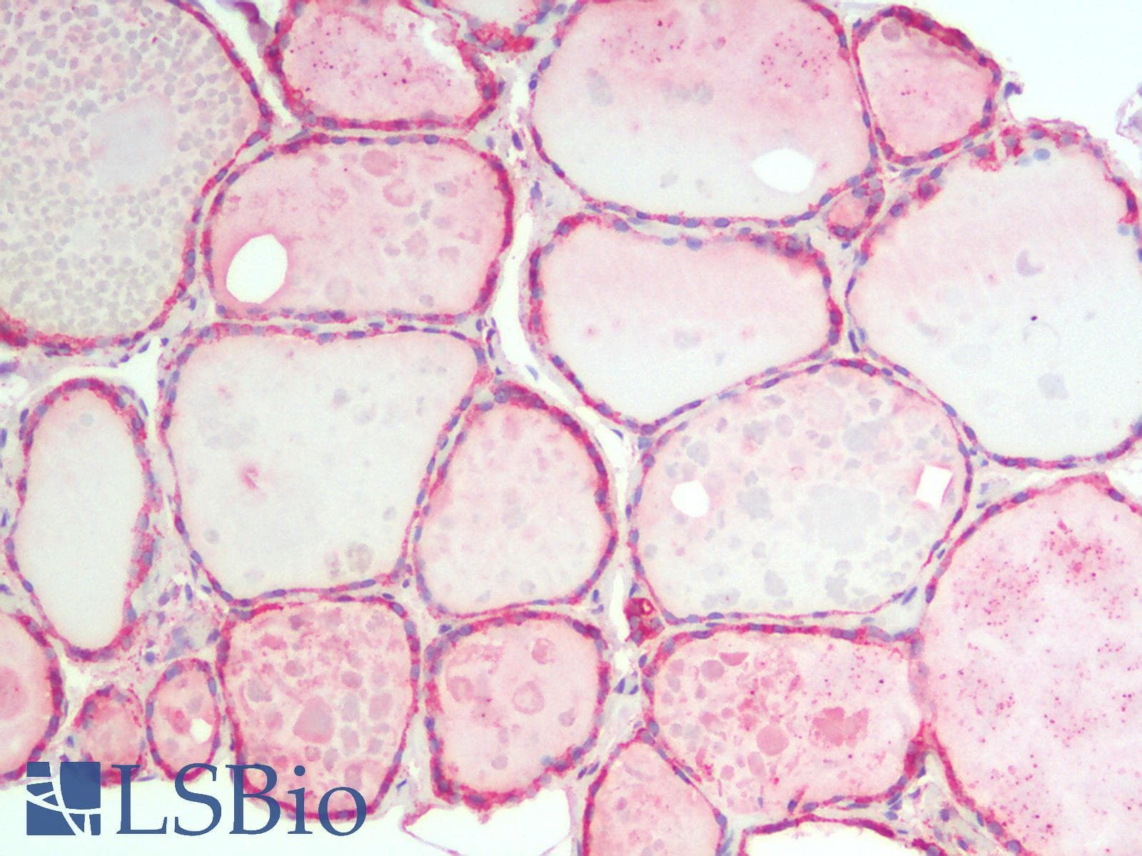 IHC-plus™ HSPA5 / GRP78 / BiP Antibody
