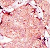 AK4 / Adenylate Kinase 4 Antibody (aa195-223)
