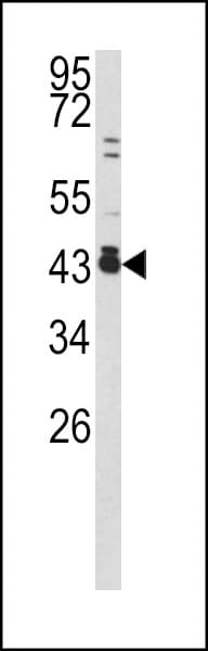 Polyclonal Rabbit anti-Human FOS / c-FOS Antibody (aa263-291, WB)
