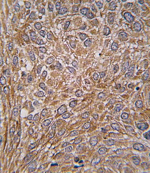 Polyclonal Rabbit anti-Human GIT1 Antibody (Tyr510, IHC, WB)