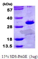 Human ETFB Protein (Recombinant His)