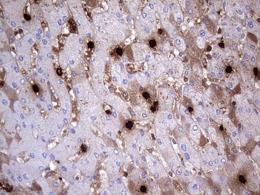 S100A9 / MRP14 Antibody (clone OTI11A12, Carrier-free)