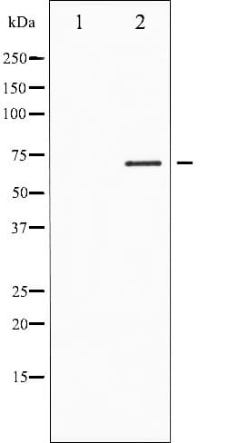 FOXO1 / FKHR Antibody (phospho-Ser319)