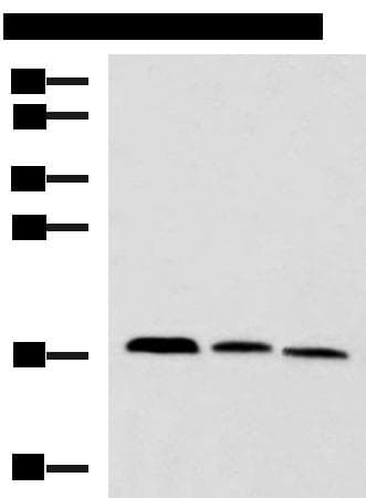 CPLX3 Antibody