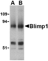 Polyclonal Rabbit anti-Human BLIMP1 / PRDM1 Antibody (IHC, WB)