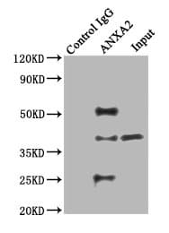 Polyclonal Rabbit anti-Human ANXA2 / Annexin A2 Antibody (aa2-339, IHC, WB)