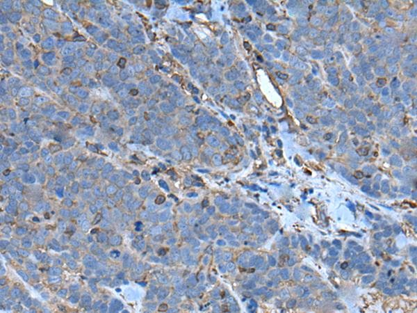 SLC24A5 / NCKX5 Antibody