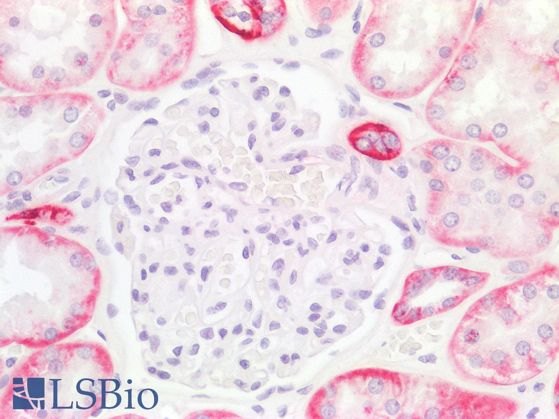 PathPlus™ Monoclonal Mouse anti-Human IL17A Antibody (clone 4K5F6, aa1-75, IHC, WB)