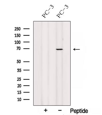 Polyclonal Rabbit anti-Human LCA3 / SPATA7 Antibody (WB)