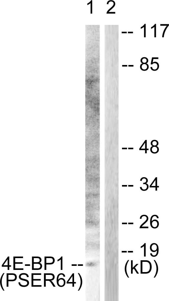 Polyclonal Rabbit anti-Human EIF4EBP1 / 4EBP1 Antibody (phospho-Ser64, IHC, WB)