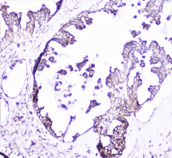 Polyclonal Rabbit anti-Human CTTN / Cortactin Antibody (IHC, IF, WB)
