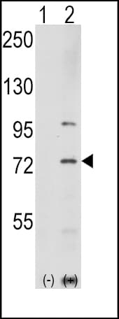 Polyclonal Rabbit anti-Human PAK1 Antibody (Thr423, IHC, IF, WB)