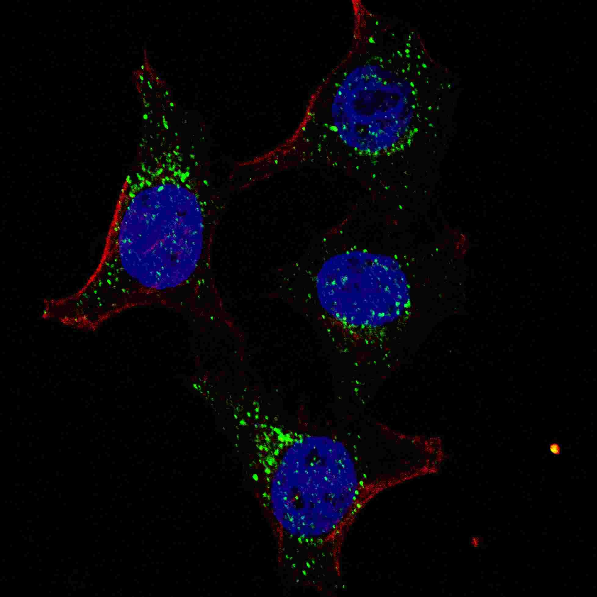 IHC-plus™ PDK4 Antibody (aa382-410)