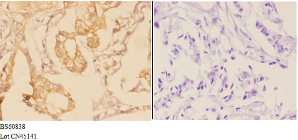 ADAM28 Antibody