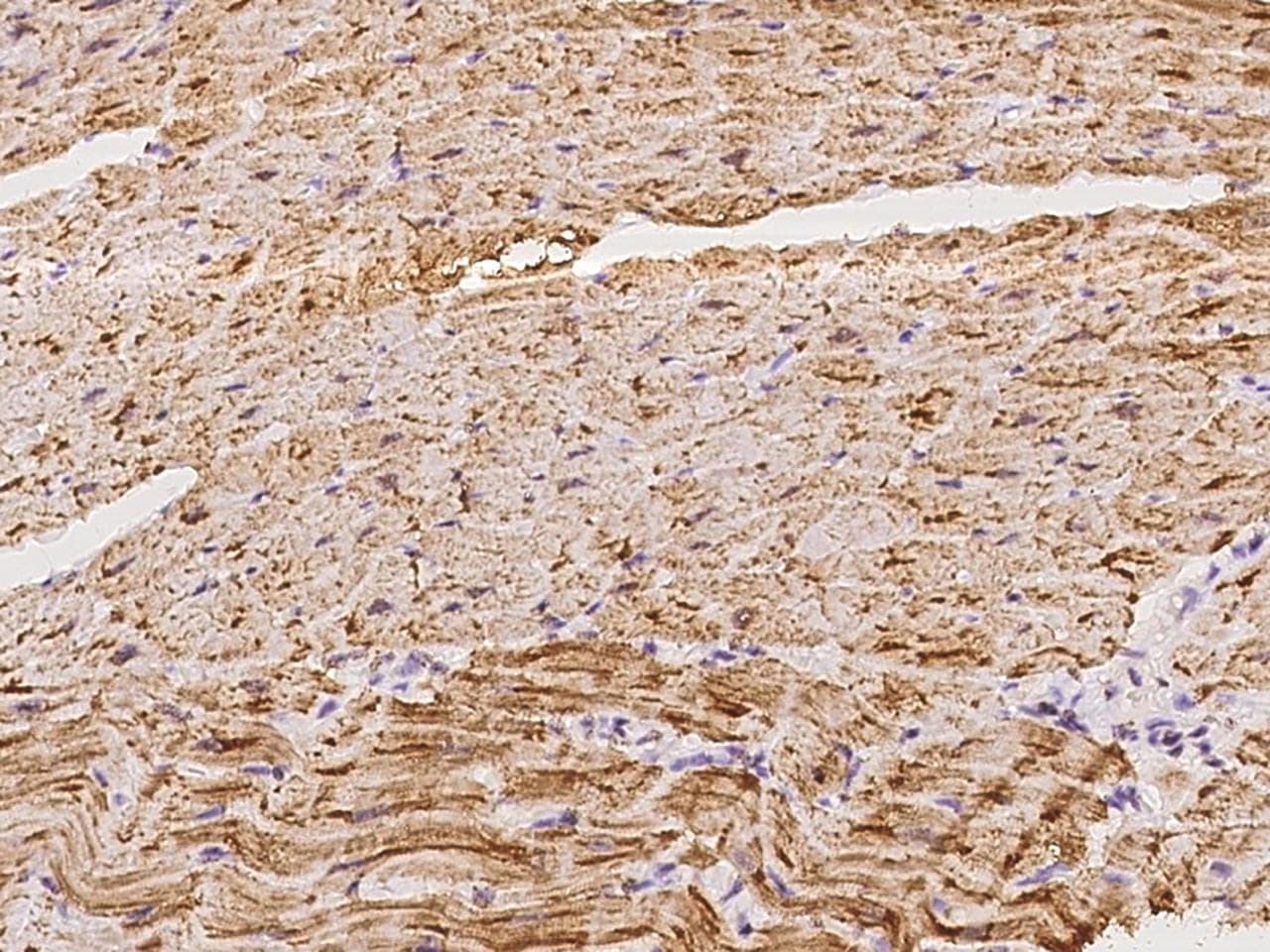 Polyclonal Rabbit anti-Human PGAM2 Antibody (IHC)