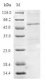 Human TIMM21 Protein (Recombinant GST, N-terminus)