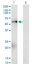 SMAD1 Antibody (clone 1D3)