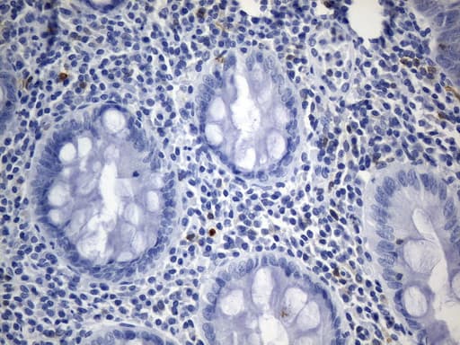 Monoclonal Mouse anti-Human CD30 Antibody (clone UMAB256, aa408-595, IHC, WB)