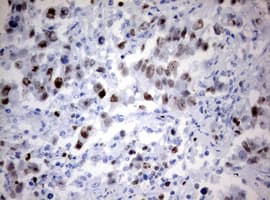 Monoclonal Mouse anti-Human MKI67 / Ki67 Antibody (clone OTI5E4, aa1160-1493, IHC)