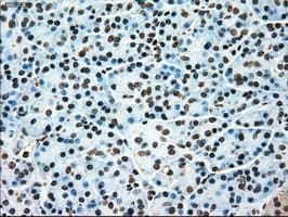 TYRO3 Antibody (clone OTI2C4)