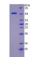 Human WT1 / Wilms Tumor 1 Protein (Recombinant)