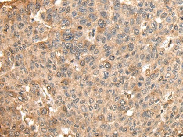 Polyclonal Rabbit anti-Human HMMR / CD168 / RHAMM Antibody (IHC)