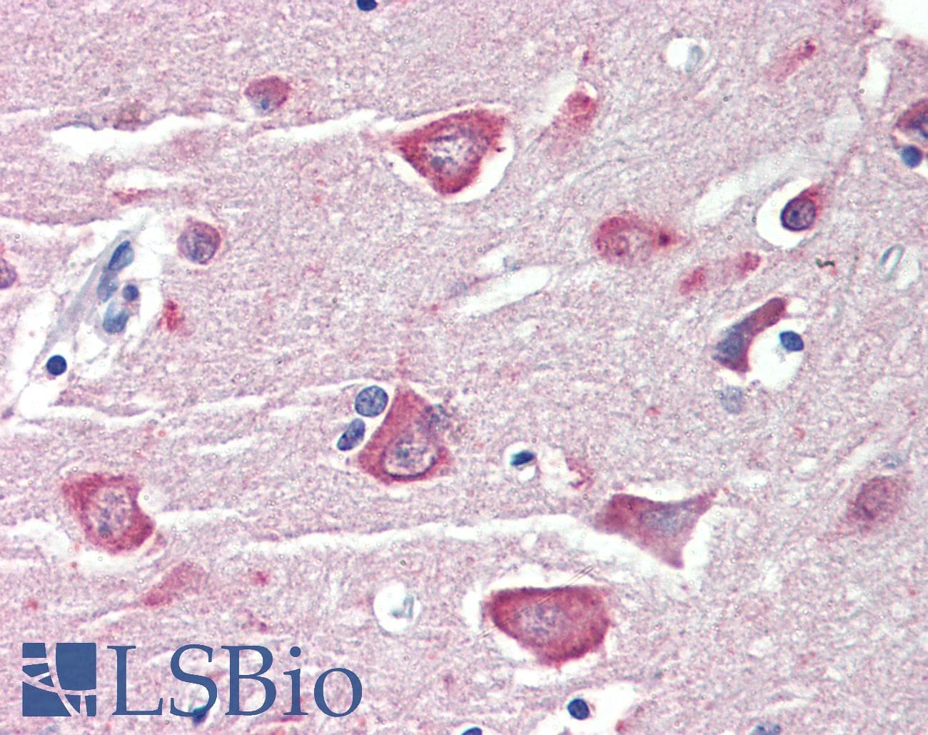 IHC-plus™ RASSF1 / RASSF1A Antibody (aa135-147)