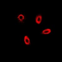 FBP1 Antibody