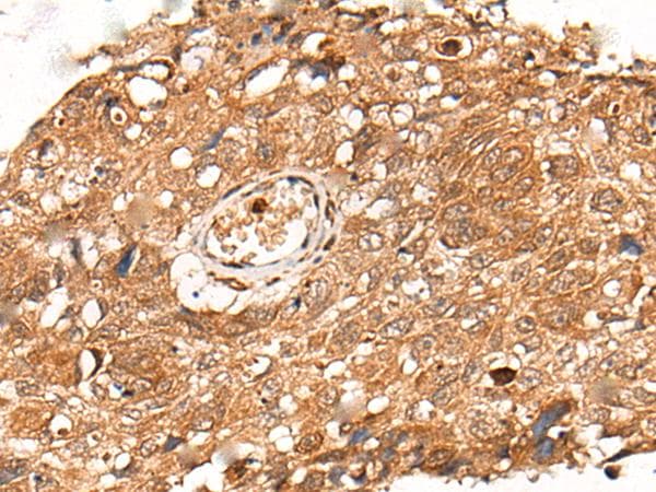 KLHL36 Antibody