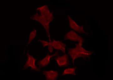 Polyclonal Rabbit anti-Human ADORA3 / Adenosine A3 Receptor Antibody (IF, WB)