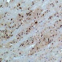 CACNB3 / Cavbeta3 Antibody