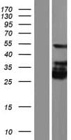 KRT28 / Keratin 28 Protein (Over-Expression Lysate Myc-DDK (Flag))